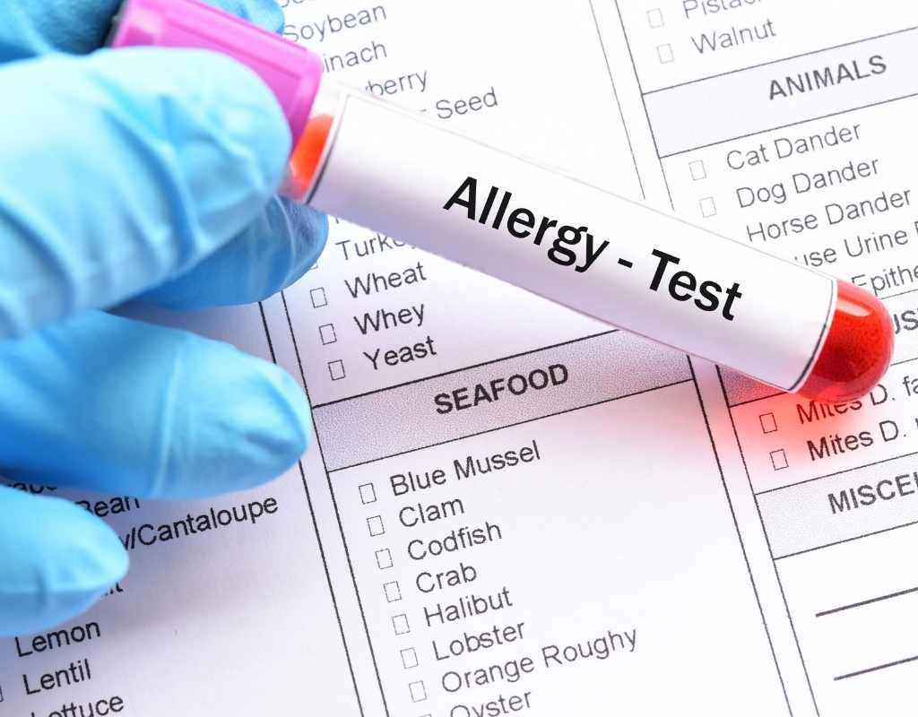 diagnóstico alergia alimentar