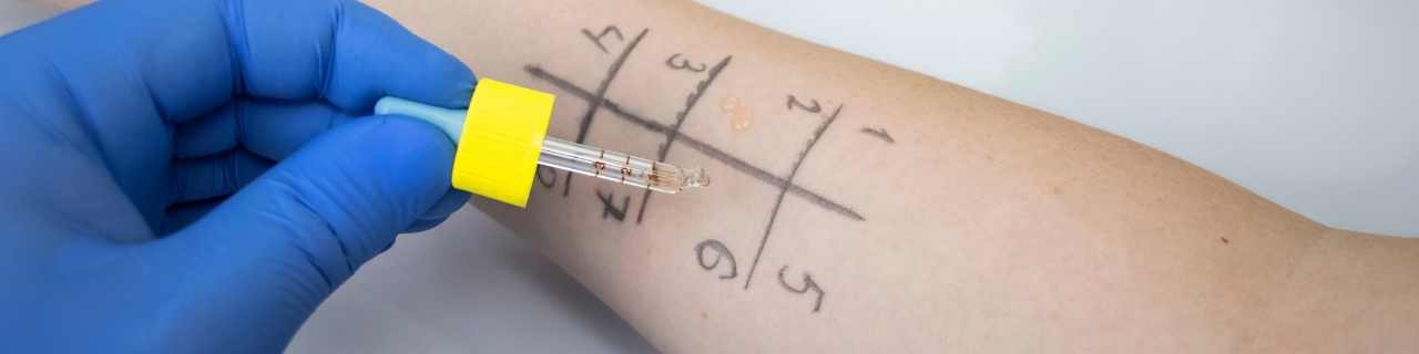 prick test